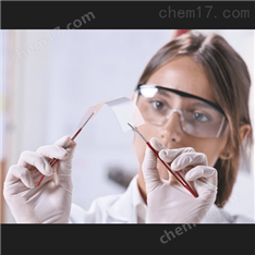 电化学传感器
