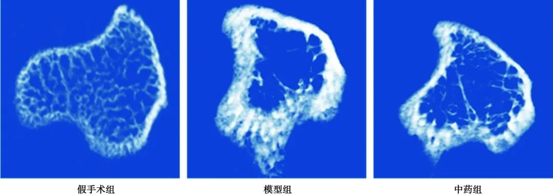 客户成果分享 | 利用Micro-CT检测小鼠样本骨组织形态