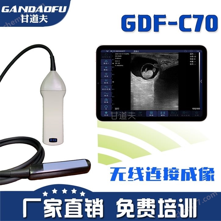 招标采购兽用无线B超价格牛羊用B超厂家报价